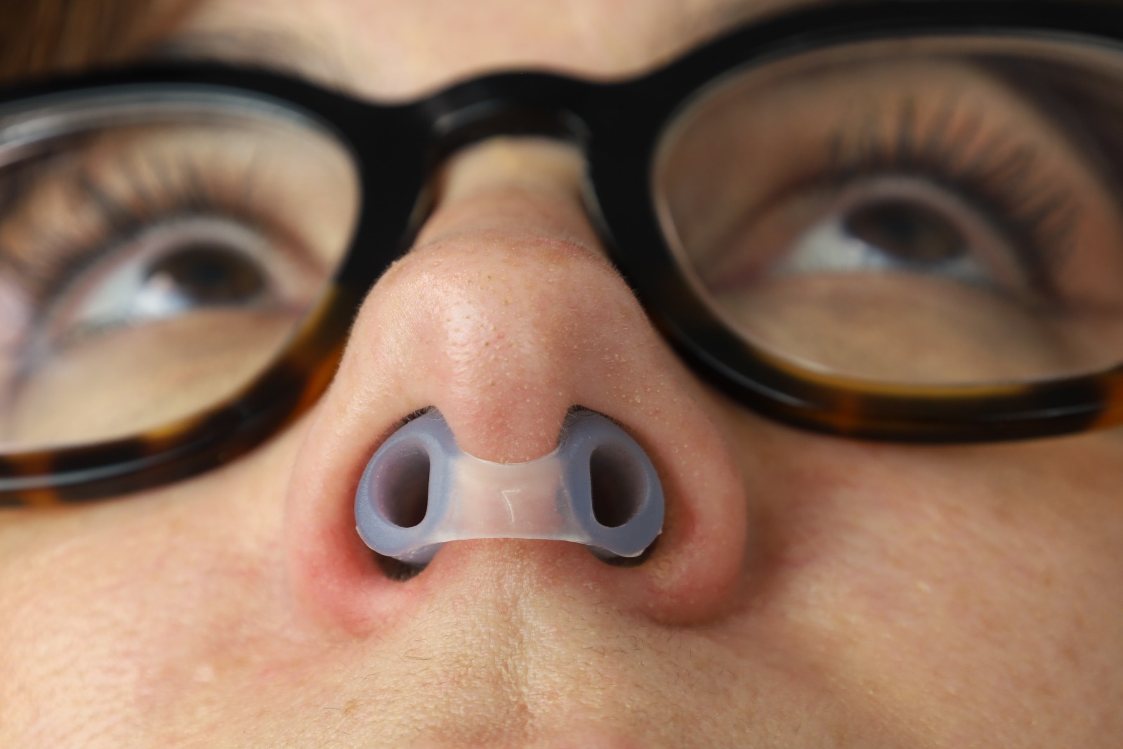 Postoperative Nasal Retainer – Pack of 10 - Image 7